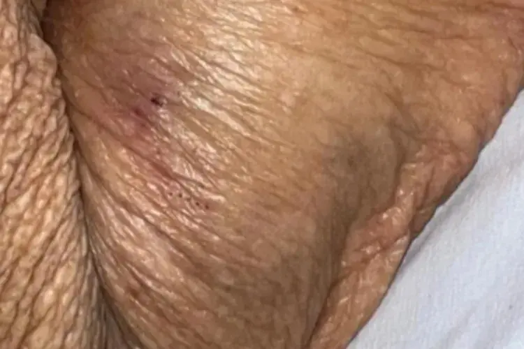 Idosa de 84 anos sofre fratura no braço durante atendimento em UPA de Caetité