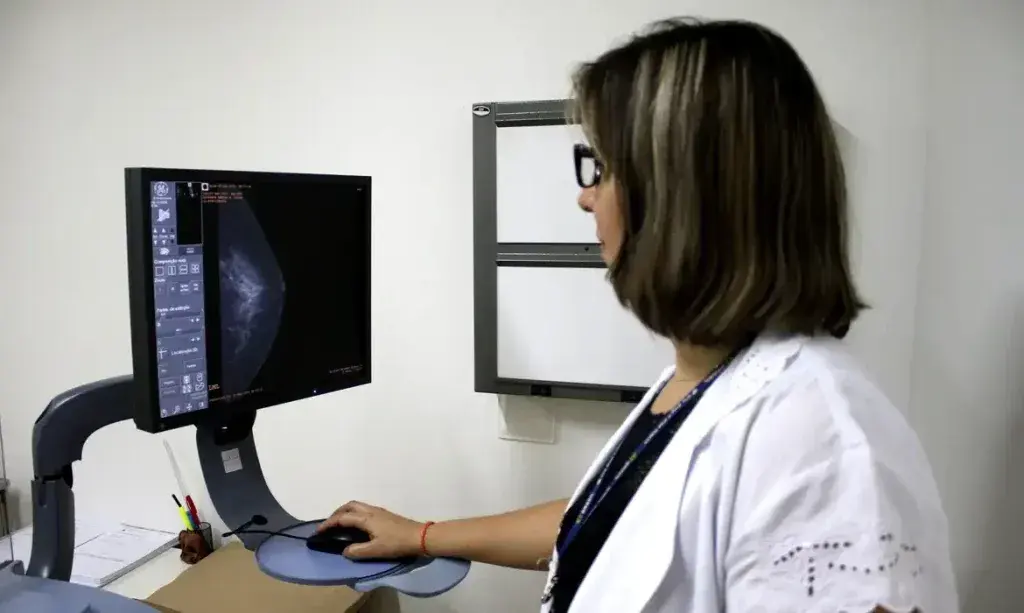 Ministério da Saúde recomenda mamografia no SUS a partir dos 40 anos